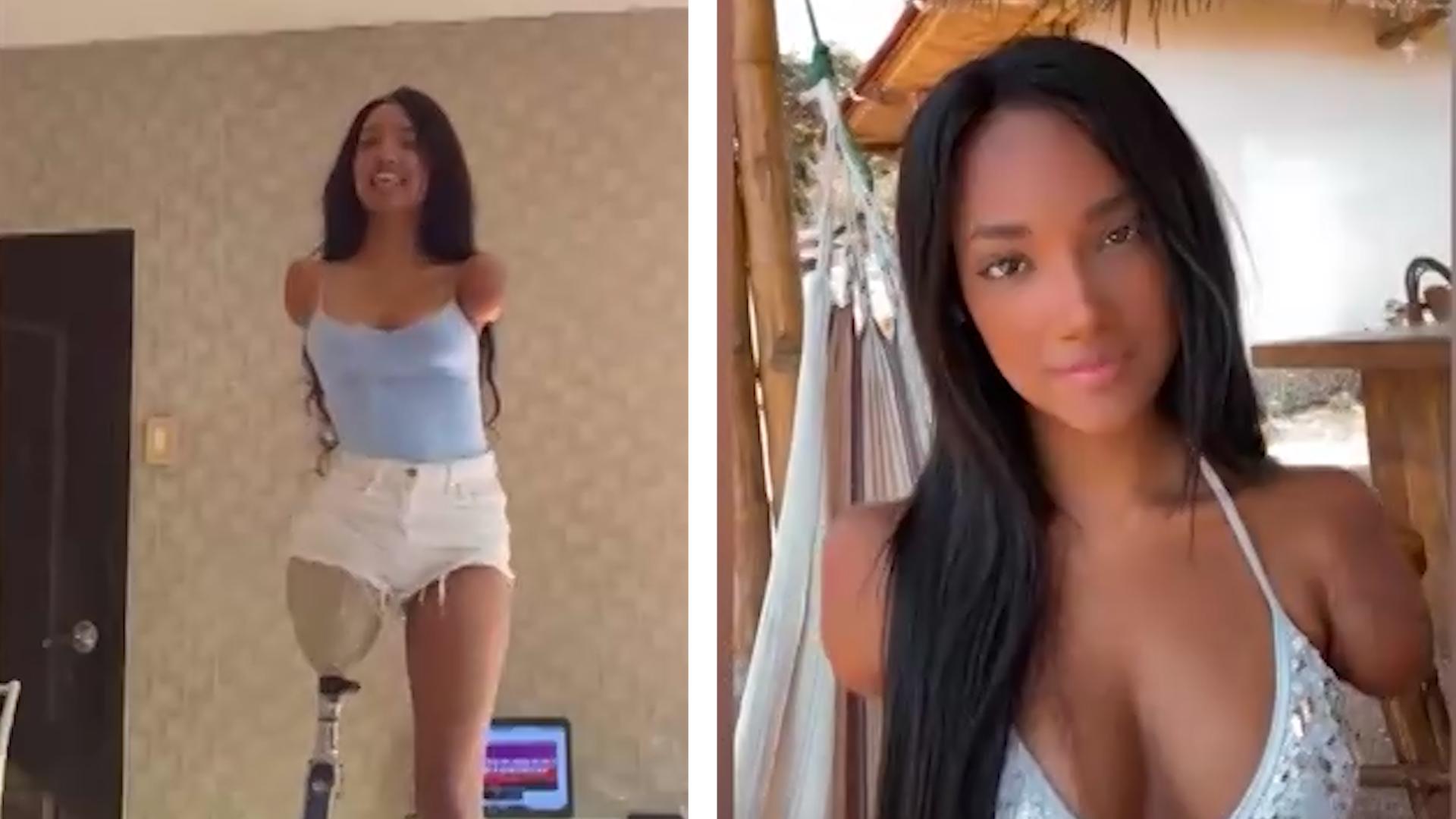 Keine Arme und nur ein Bein: Model Victoria inspiriert Fans Sie will als Vorbild vorangehen