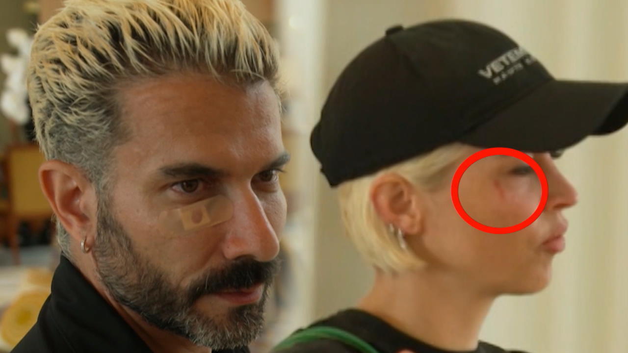 Was war bei Marc Terenzi und Verena Kerth los? Verletzungen im Gesicht