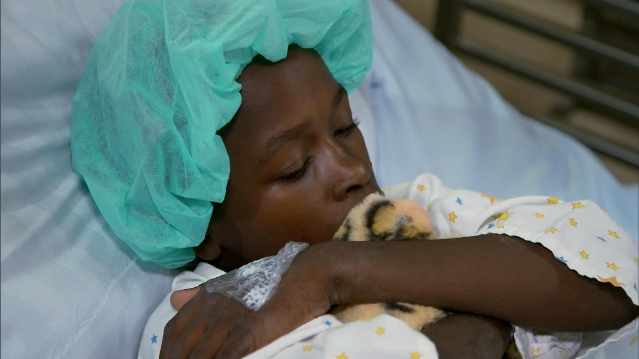 Chirurg schenkt Junge (11) neues Leben Nach schwerem Brandunfall