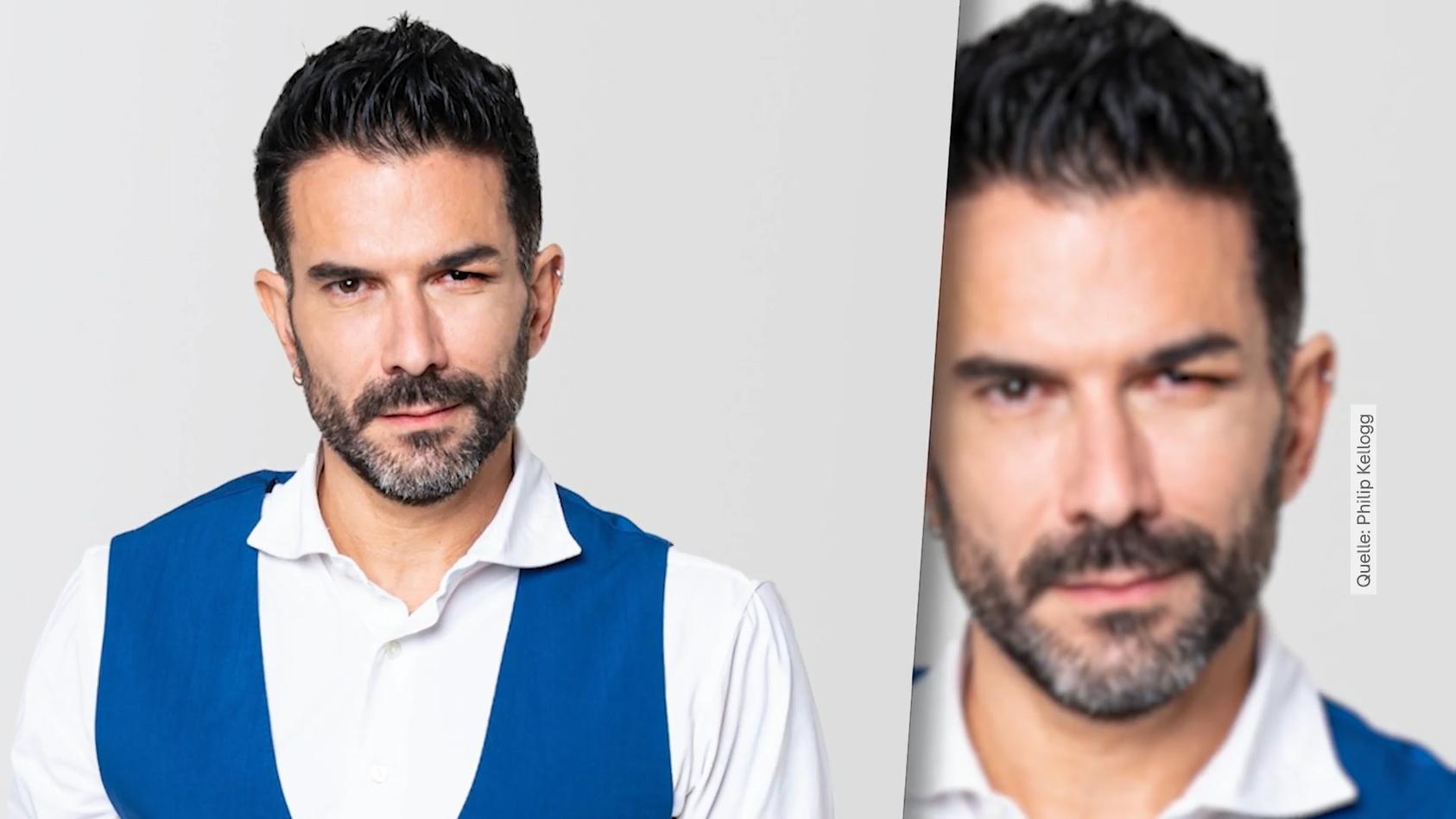 Blaues Auge für Marc Terenzi! Band-Rauswurf: