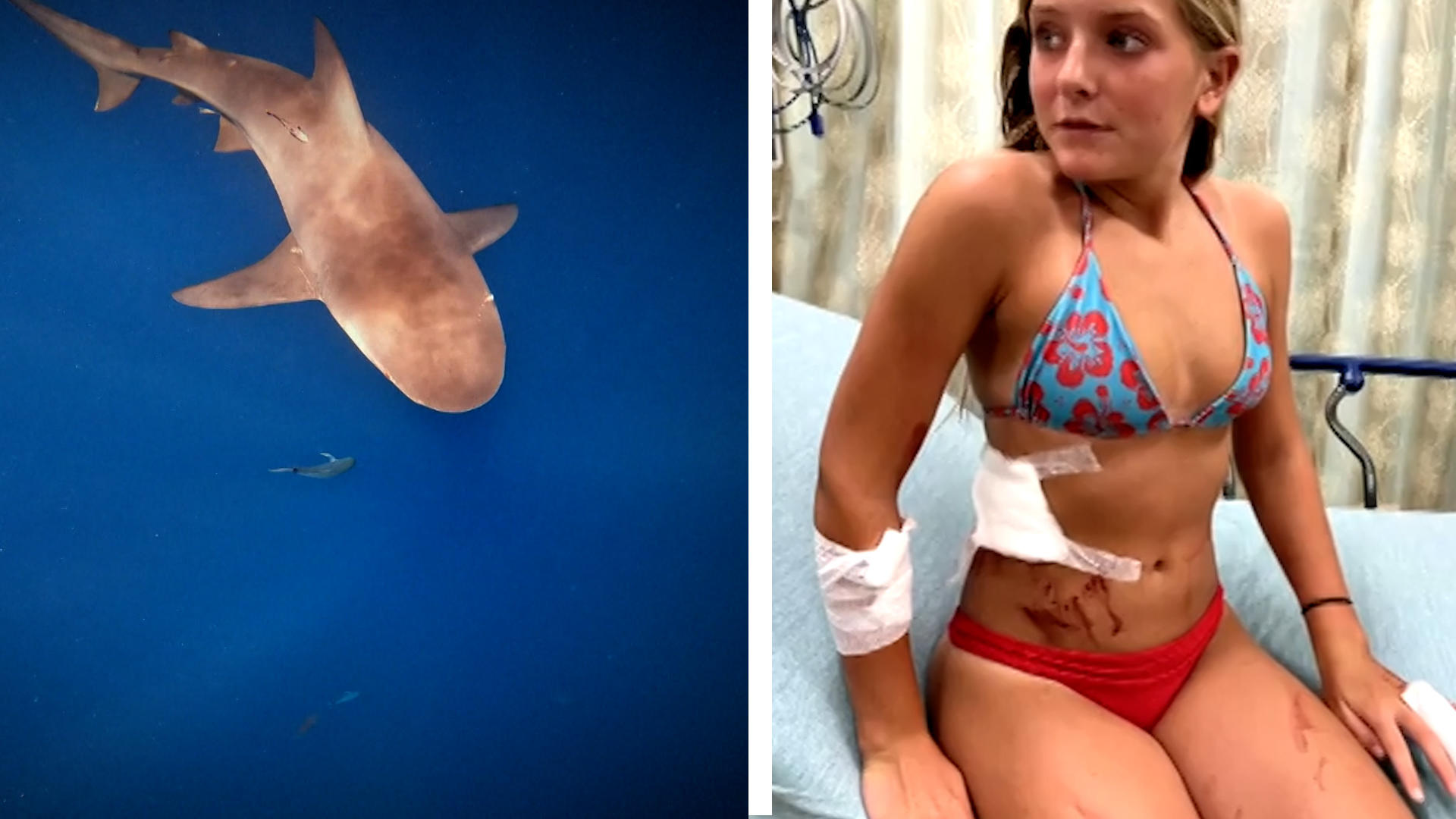 Direkt am Strand: Ella (13) hat eine Hai-Attacke überlebt! Bisse im Bauch