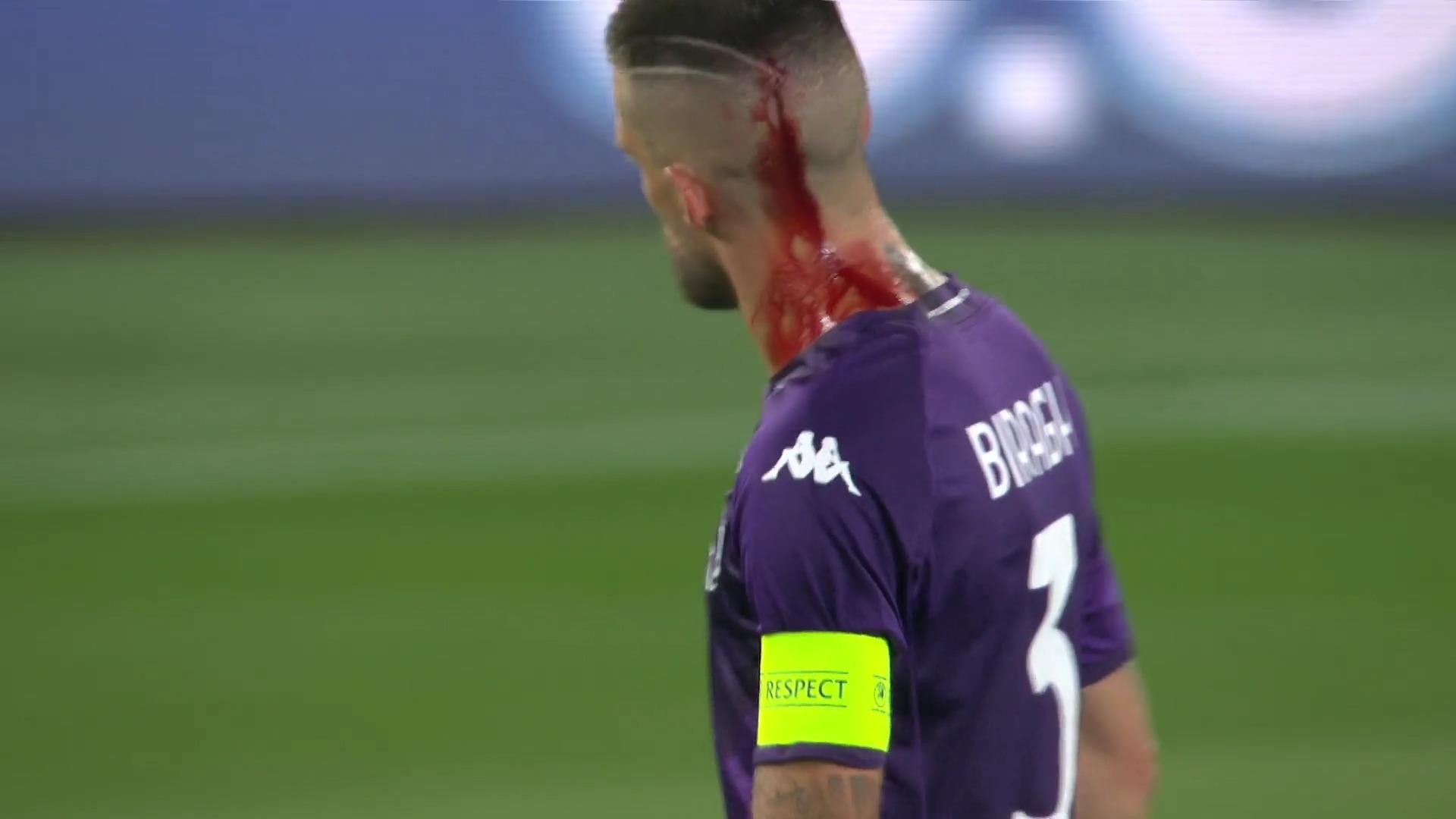 Prager Becherwurf! Florenz-Spieler blutet am Kopf UEFA Europa Conference League