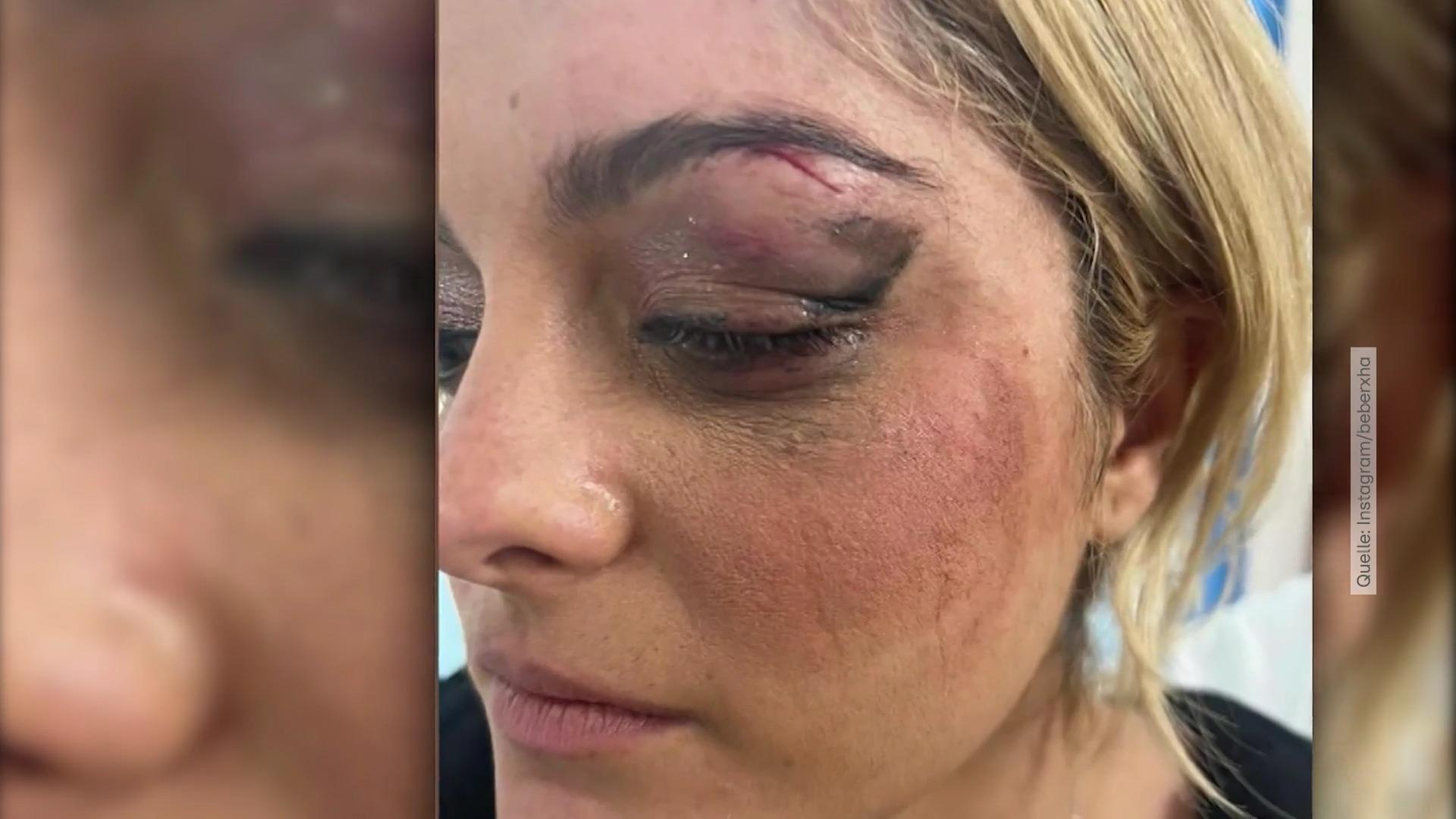 Bebe Rexha während Konzert mit Handy beworfen Das muss doch nicht sein!