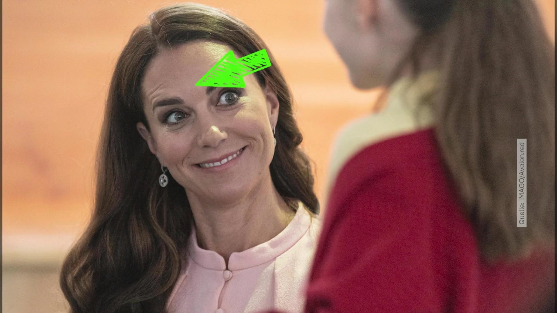 Hat Prinzessin Kate tatsächlich nachgeholfen? Botox-Gerüchte