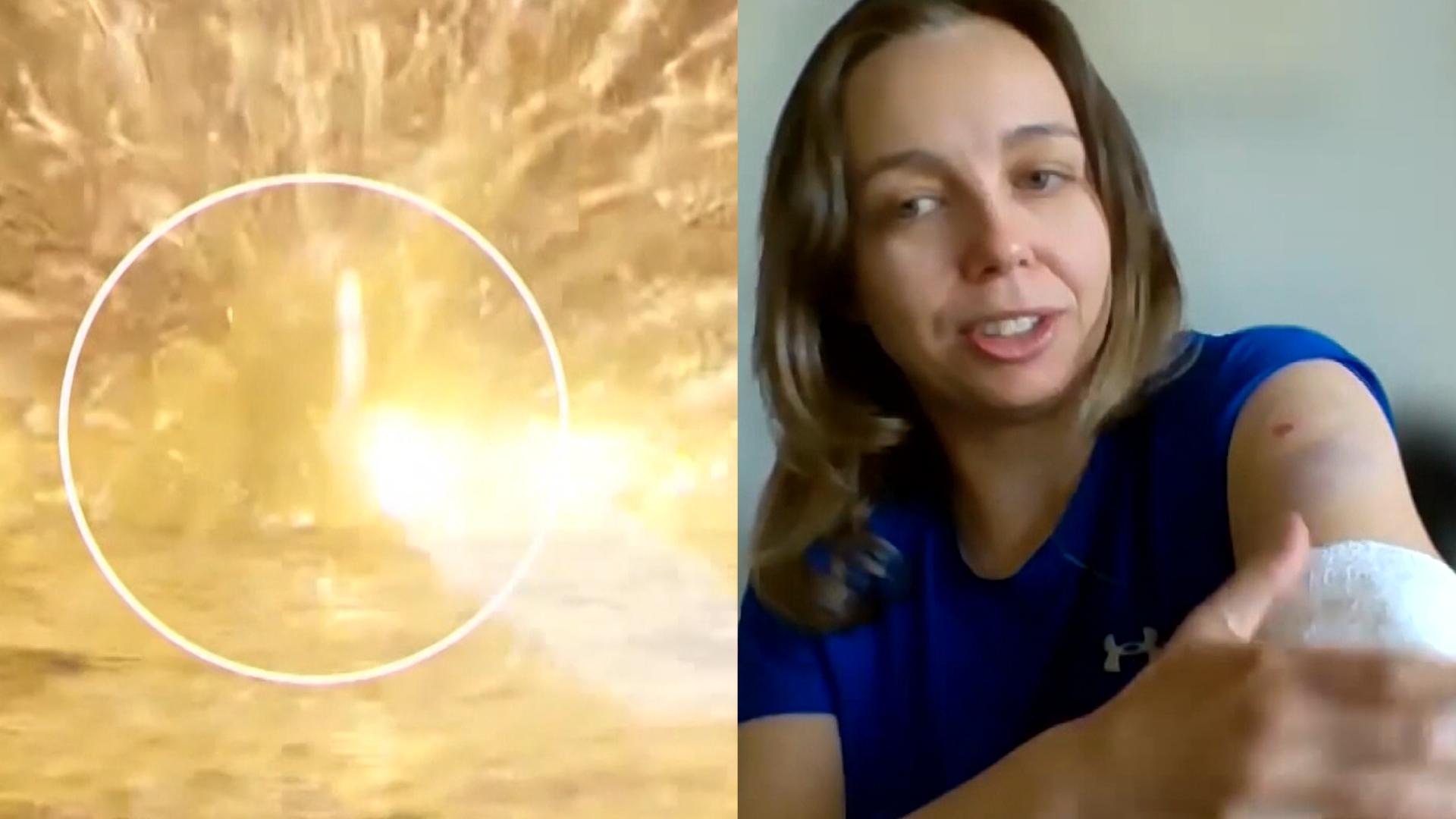 Querschläger verletzt Frau am Arm Feuerwerk explodiert zu nah am Boden