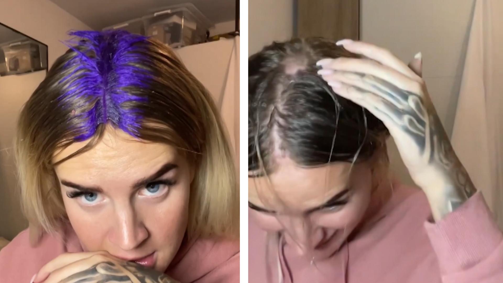 Anna Iffländer schmiert sich Nagelkleber auf Kopf Ach du heilige Pläte!