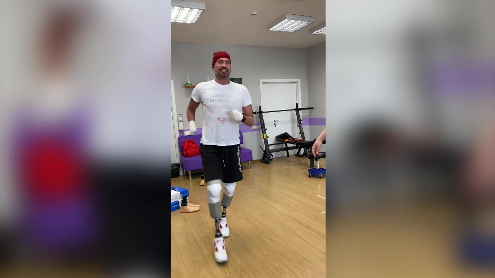 Nach Beinamputation: Roman Kostomarow Macht Erste Schritte Mit Beinprothese