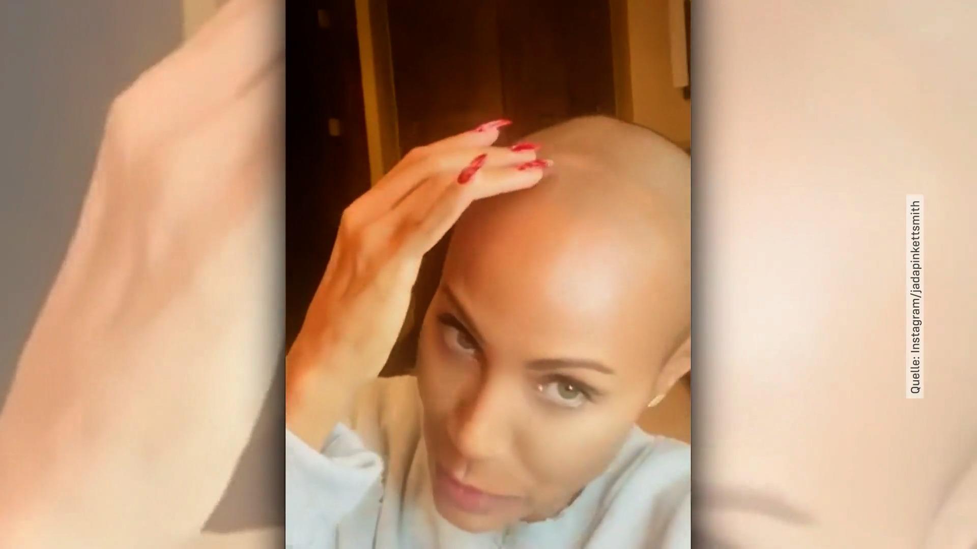 Jada Pinkett Smith feiert ihre Stoppel Nach kreisrundem Haarausfall