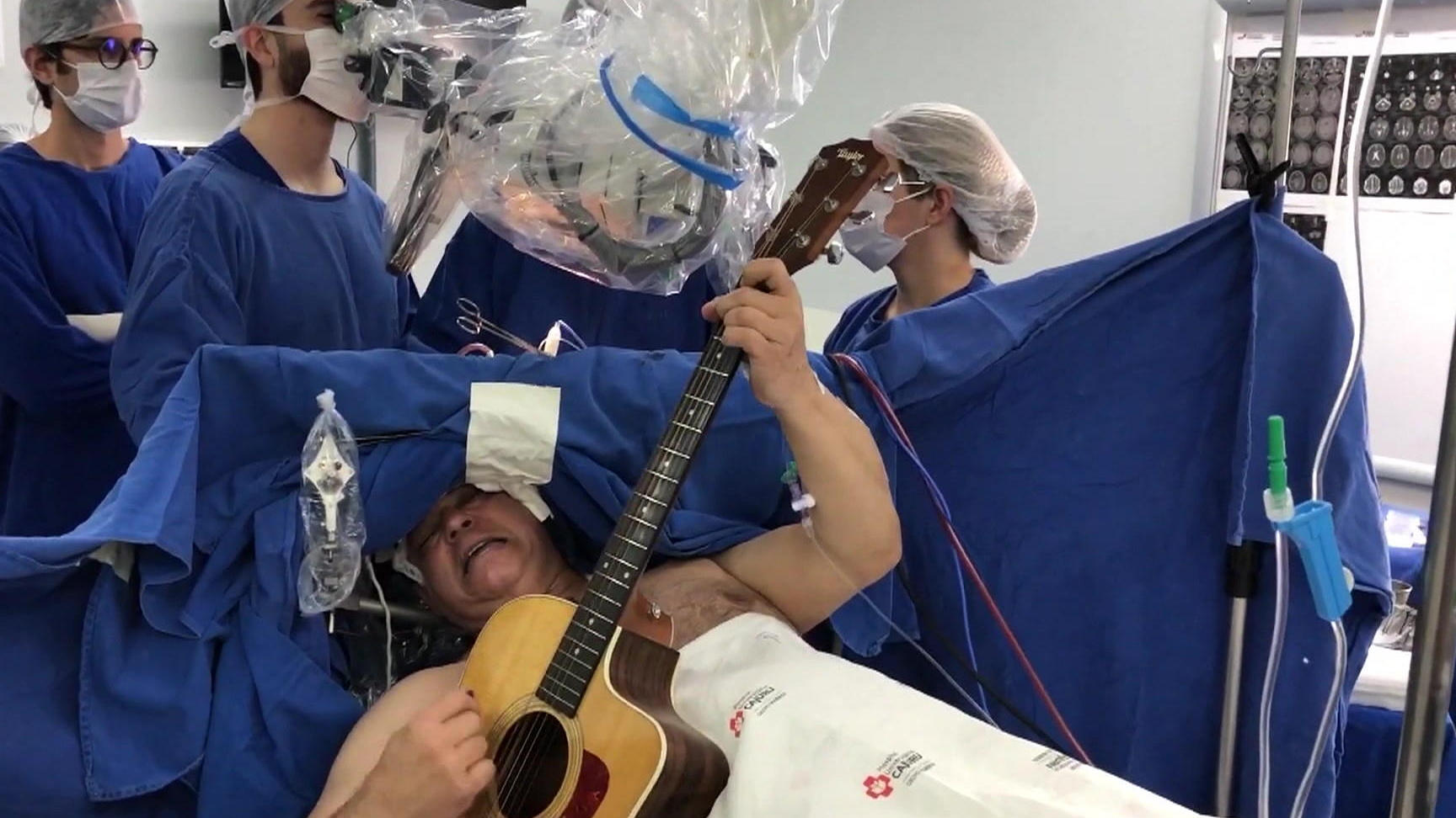 Un uomo suona la chitarra mentre i dottori rimuovono un tumore al cervello Concerto in sala operatoria!
