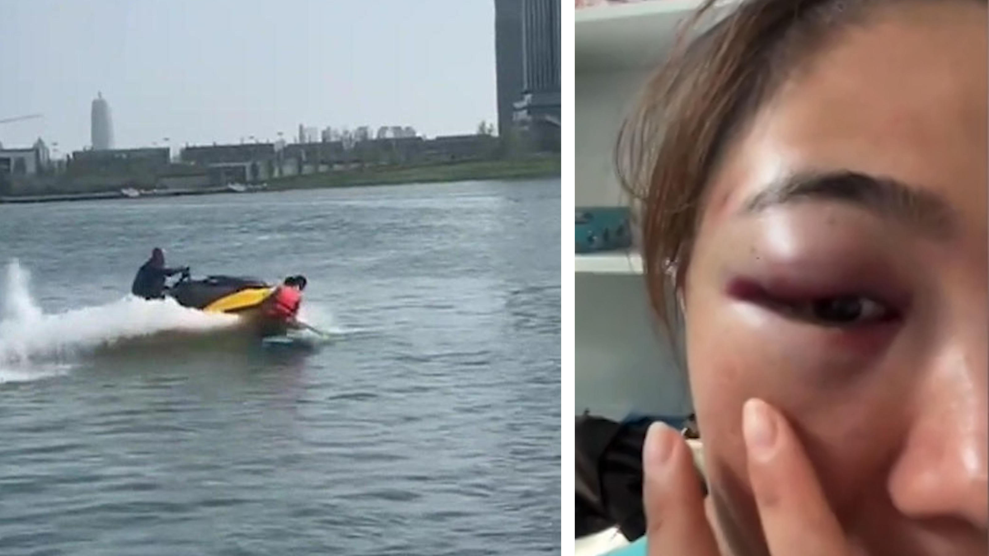 Seorang pria menabrak seorang wanita di papan dayung - dengan jet ski!  sengaja?