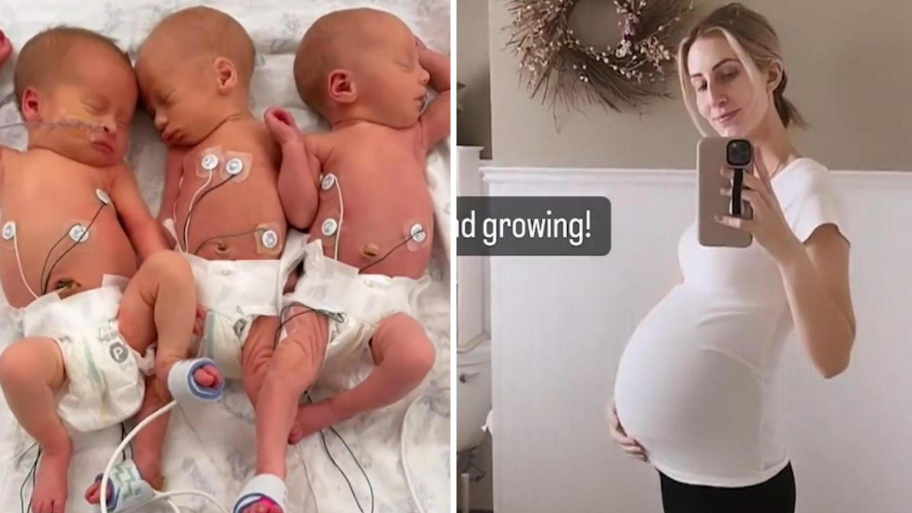 Seorang wanita hamil dan melahirkan anak kembar tiga sepuluh hari sebelum inseminasi buatan!