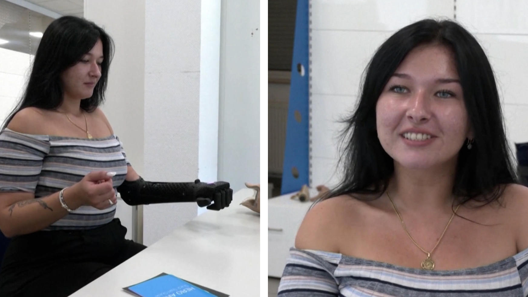 Dominika (25 tahun) memiliki lengan robot pertama di Jerman, dan harapan hidupnya terkabul