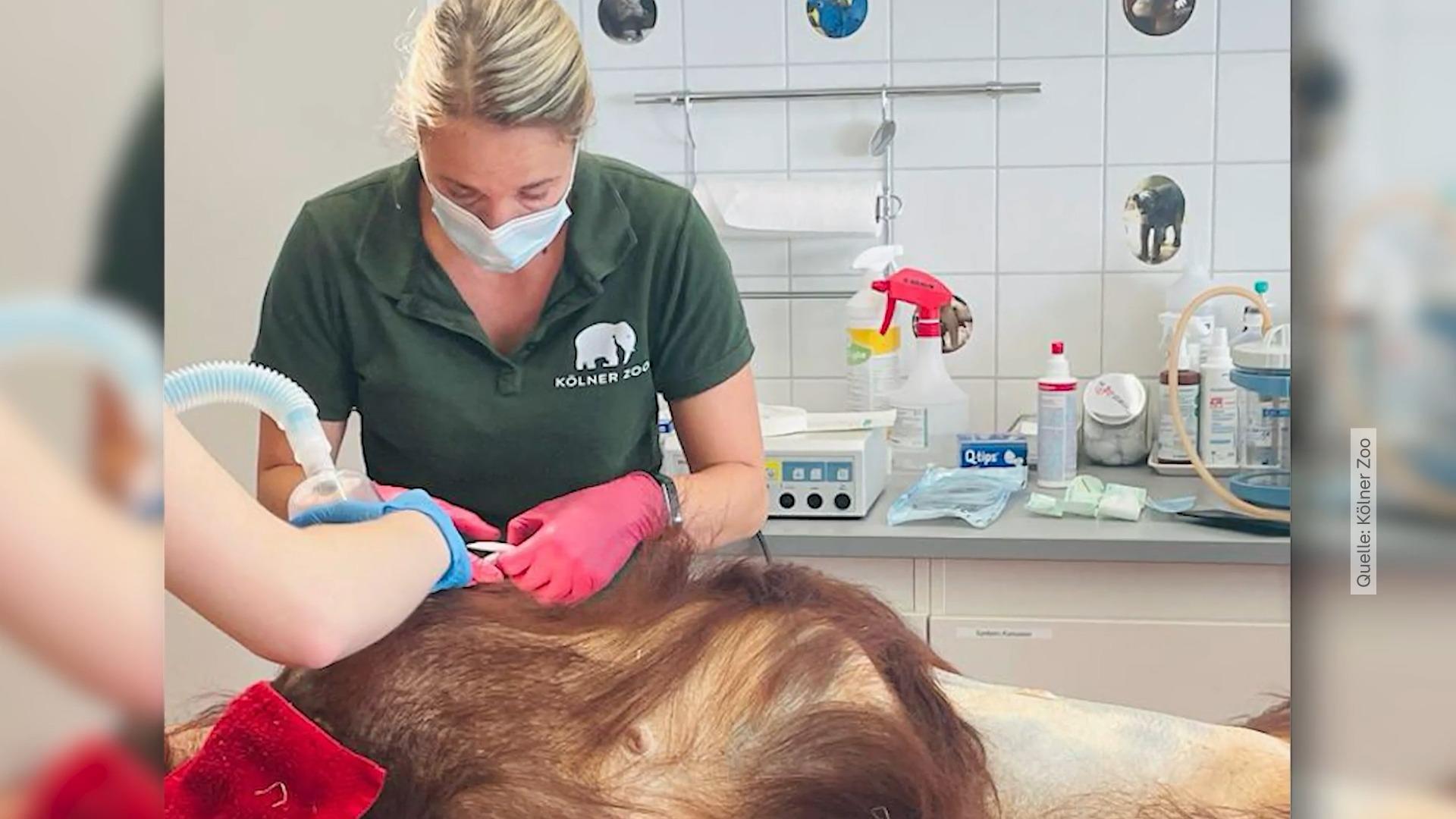 Ungewöhnlicher Eingriff im Kölner Zoo Frauenärztin rettet Orang Utan