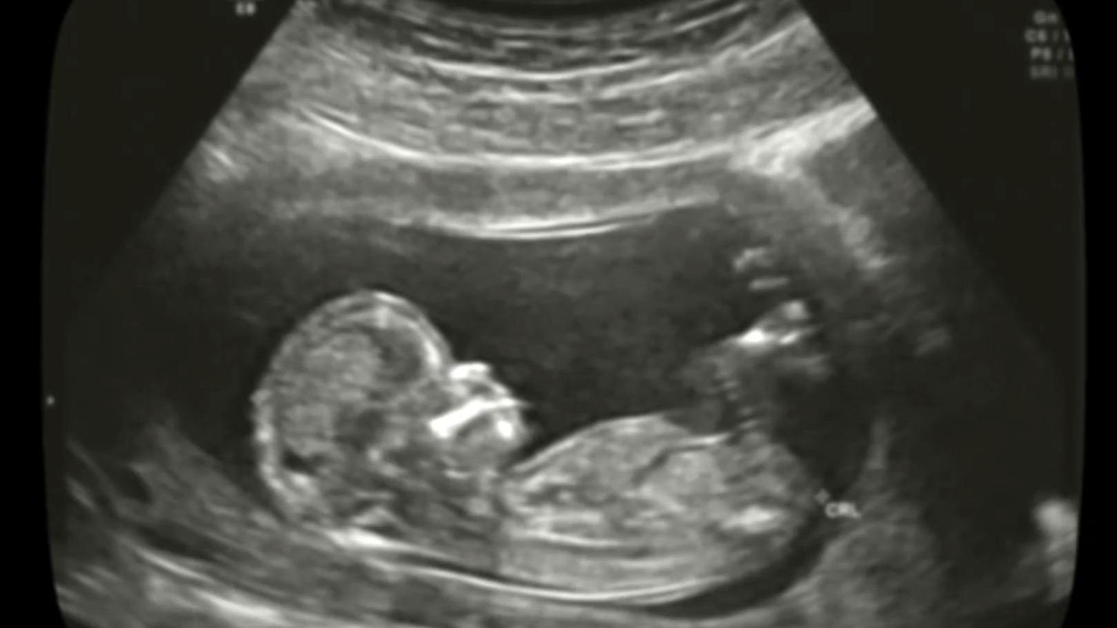 Diese Geräusche nimmt ein Fötus im Mutterleib wahr Dieses Video müssen Sie HÖREN!