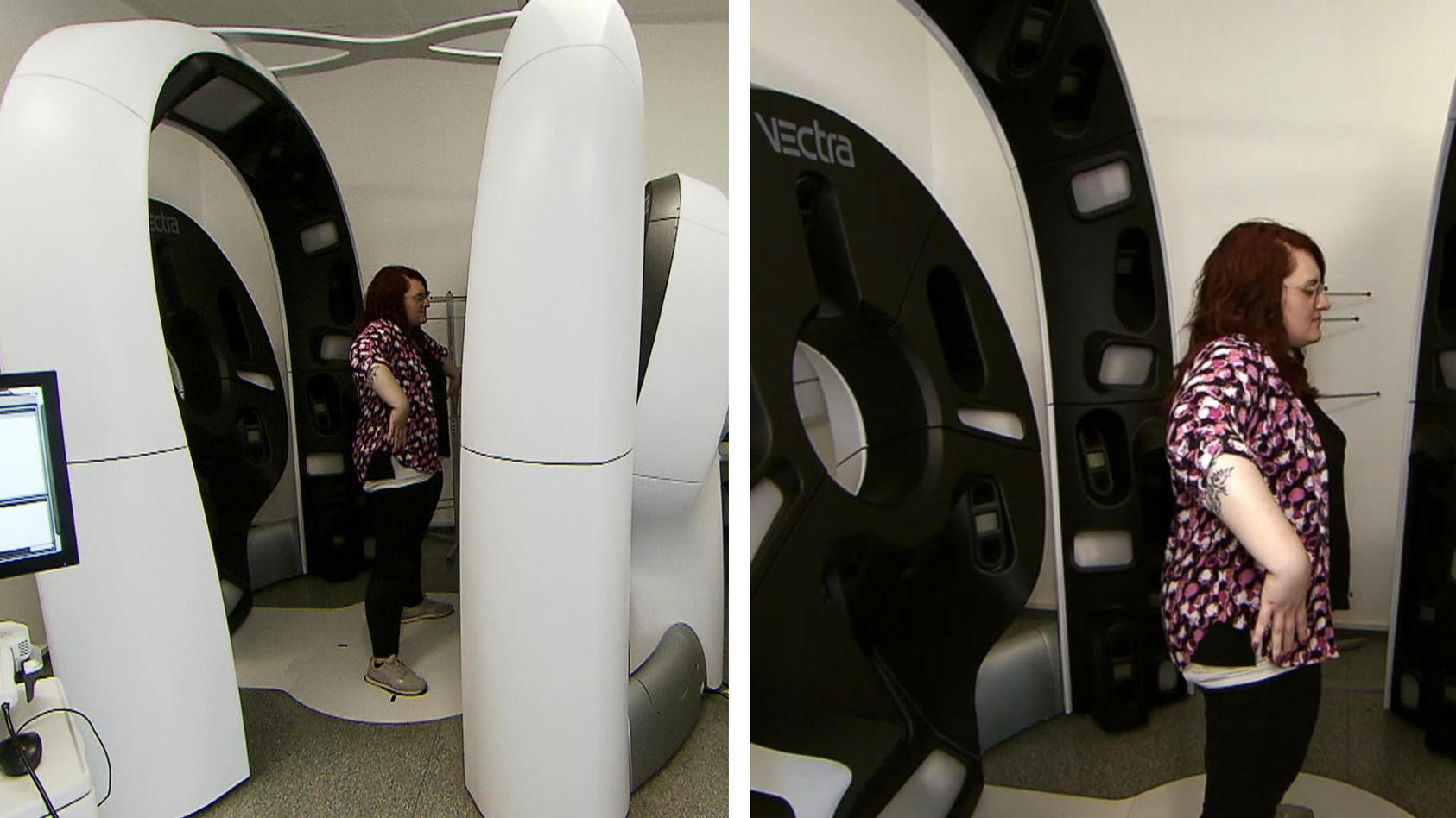 Superscanner spürt Hautkrebs in Sekunden auf Mit 92 Kameras!