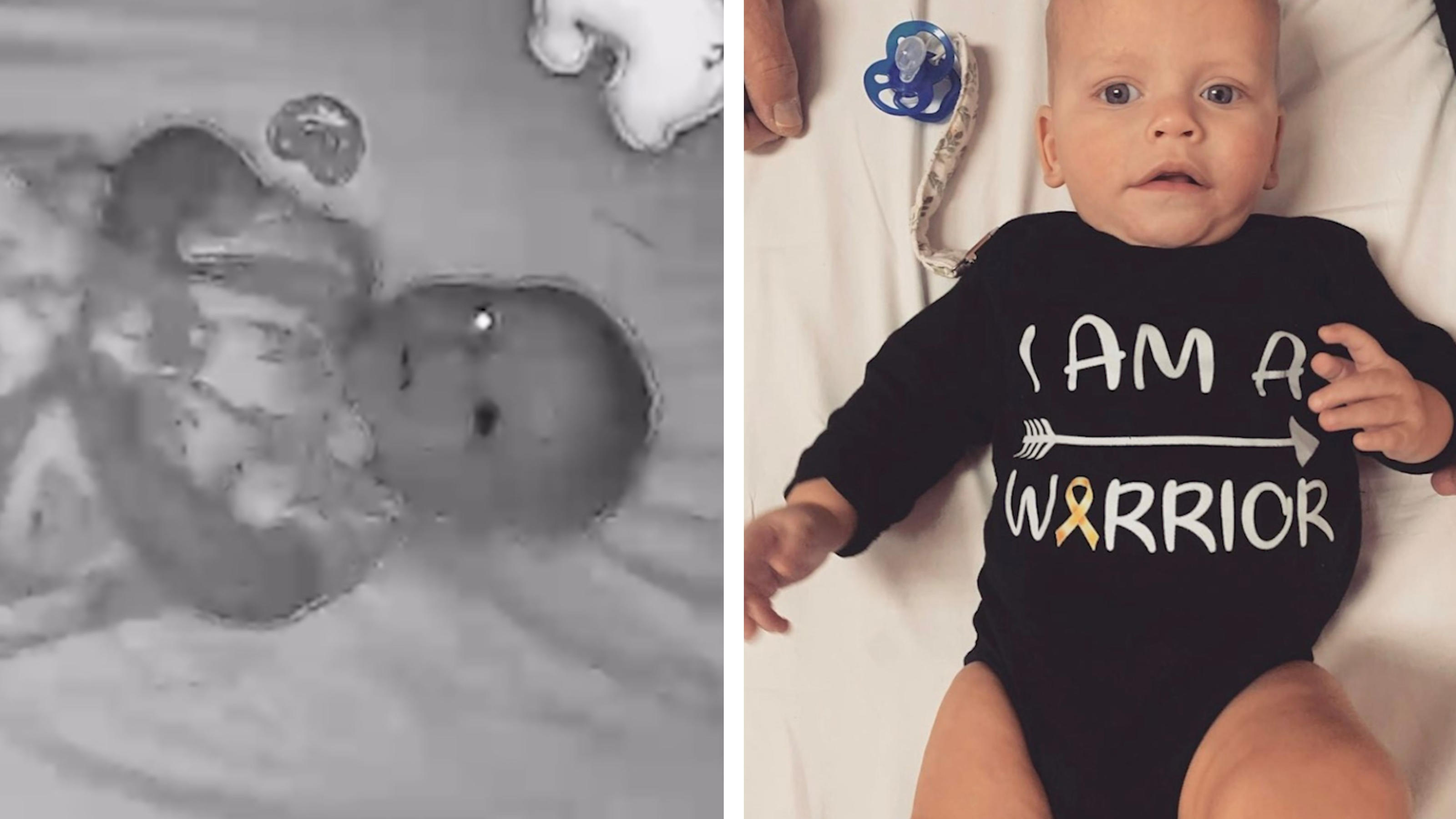 Dank Kinder-Kamera: Mutter erkennt bei Baby Krebs Sein Auge sah aus wie ein schwarzes Loch