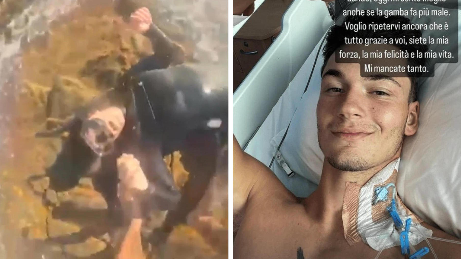Hai-Attacke beim Schnorcheln: Mann filmt Überlebenskampf Italiener (20) verliert sein linkes Bein